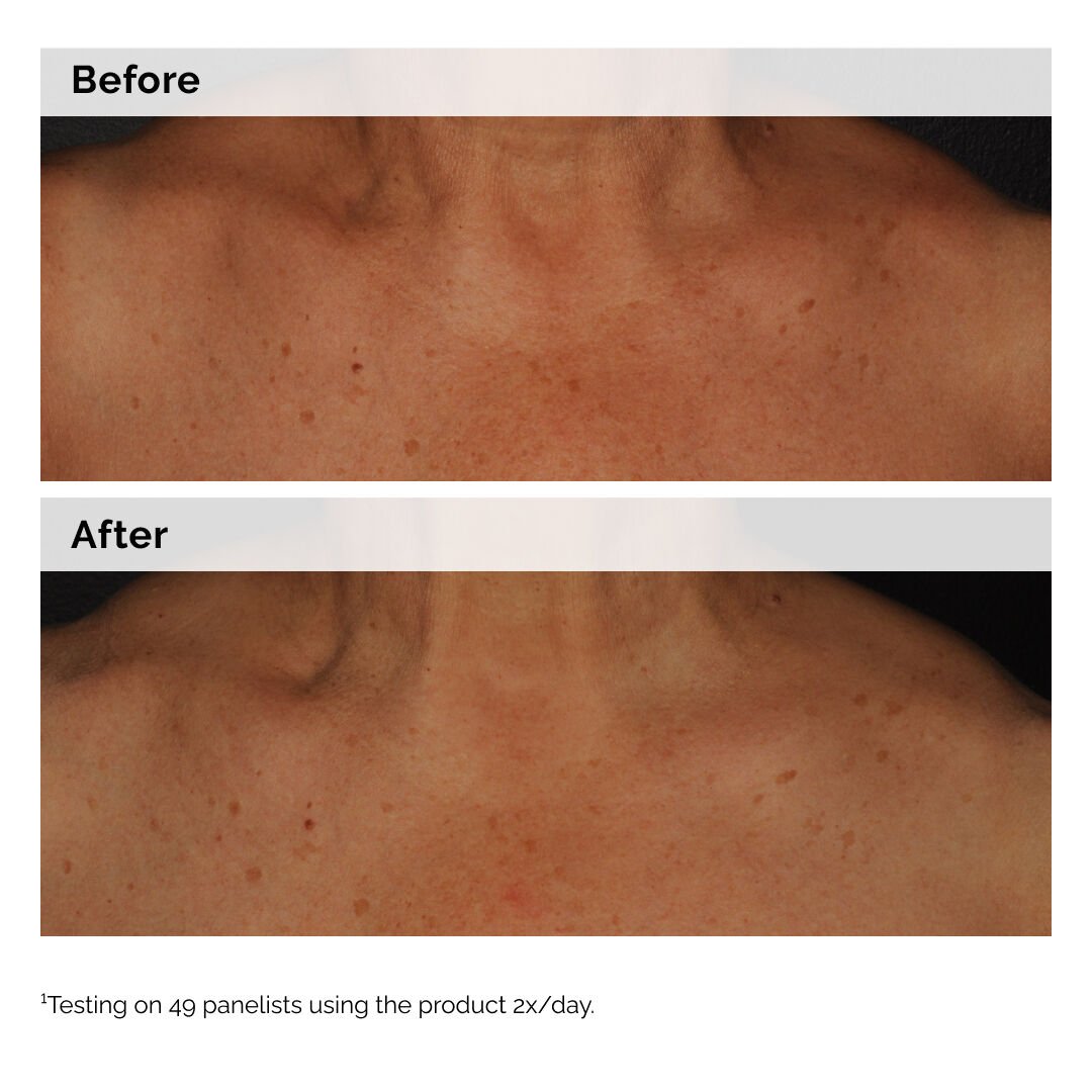 Niacinamide 5% Face and Body Emulsion 100ml - Image 2