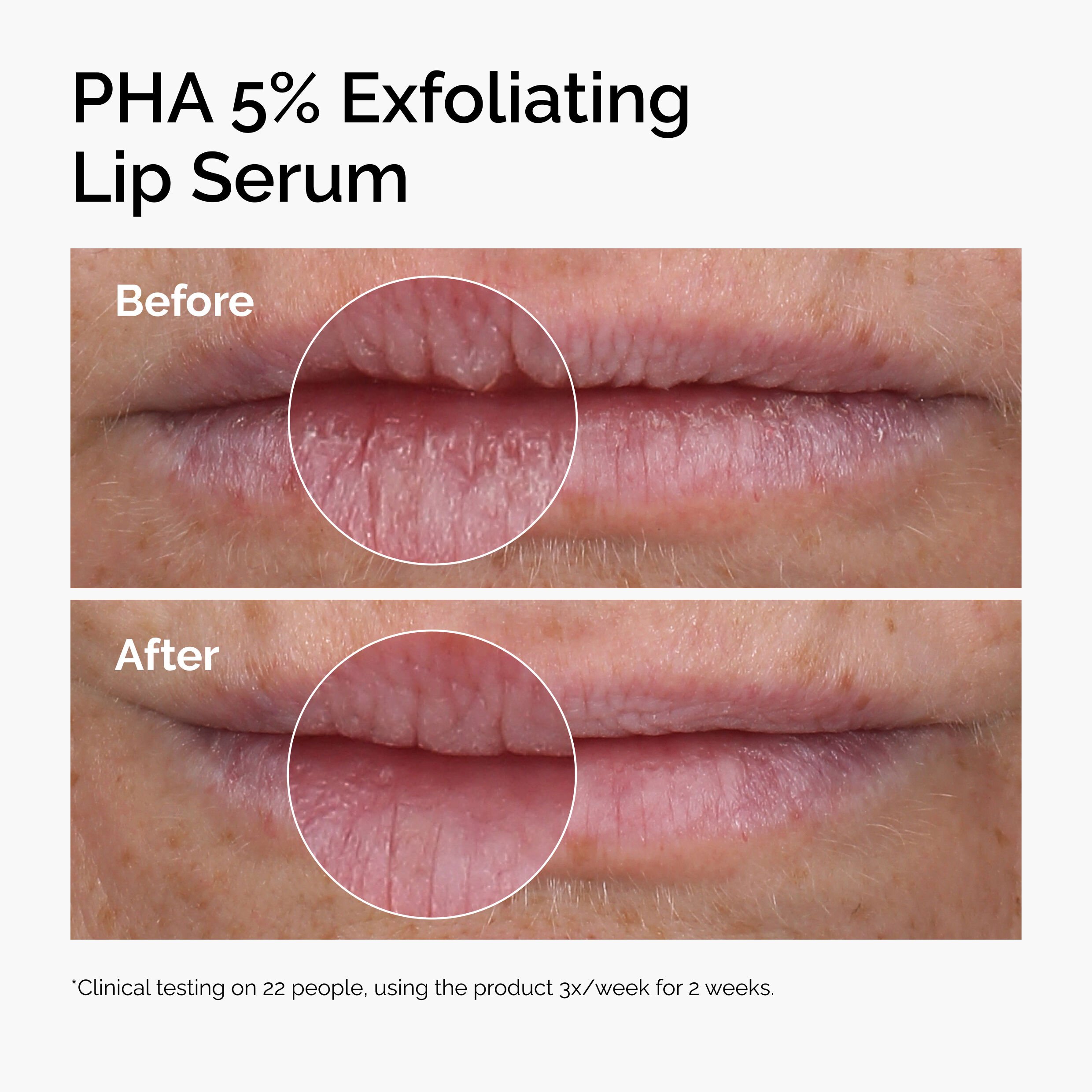 PHA 5% Exfoliating Lip Serum 15ml - Image 3
