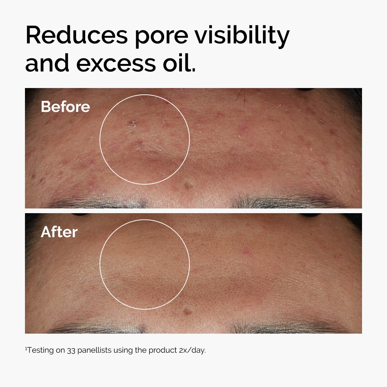 Niacinamide 10% + Zinc 1% 30ml - Image 4